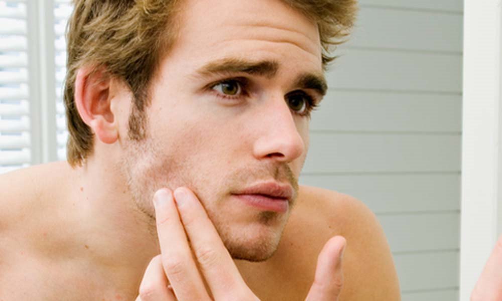 Nguyên nhân và cách chữa trị bệnh nám da mặt ở nam giới