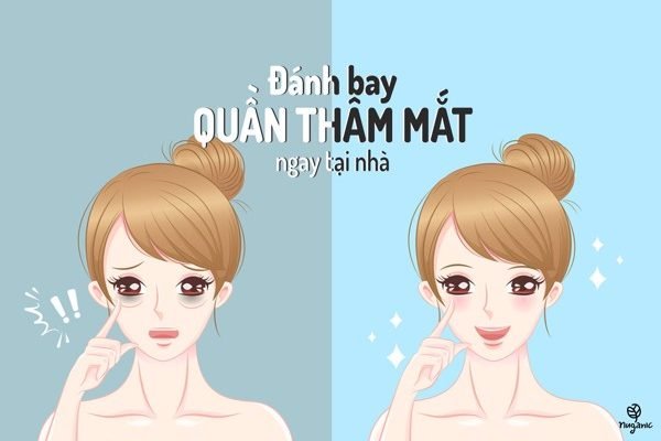 Đánh bay quầng thâm mắt hiệu quả