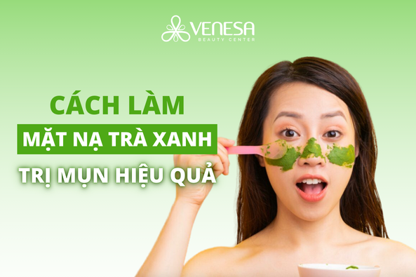 5 cách làm mặt nạ trà xanh trị mụn “đánh bay” mụn cứng đầu!